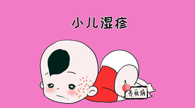 婴儿湿疹的类型 宝宝湿疹怎么办