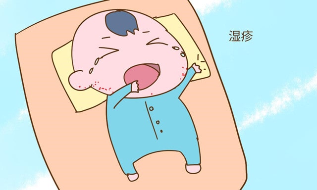 婴儿湿疹的类型 宝宝湿疹怎么办
