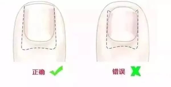 给宝宝剪指甲这件事，很多家长都做错了