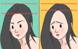 产后脱发怎么办和原因