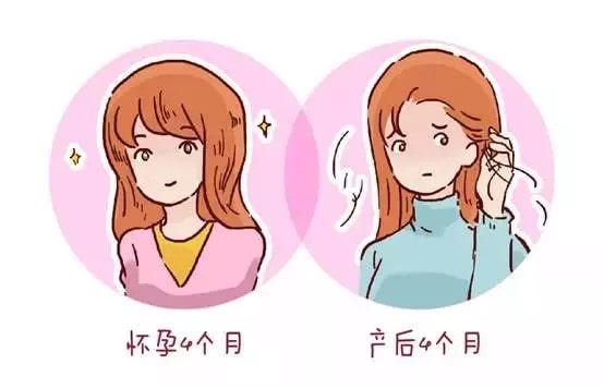 产后脱发怎么办和原因