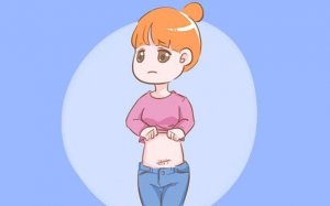 剖腹产伤口护理措施