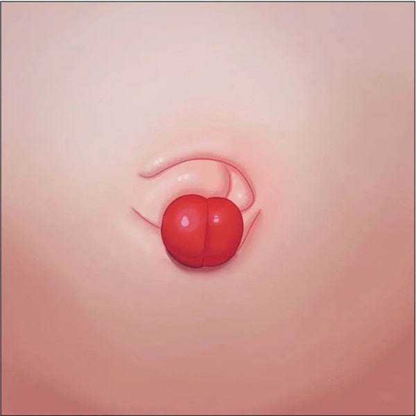 初生婴儿脐带护理很重要，5种异常要注意