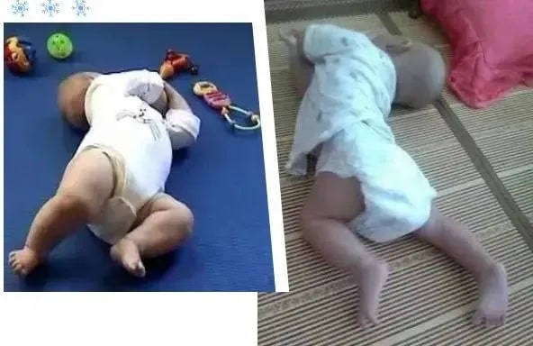 宝宝肌张力高的临床表现有哪些？