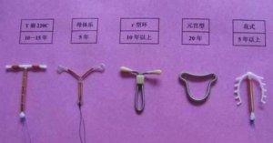 产后避孕，上环好不好？