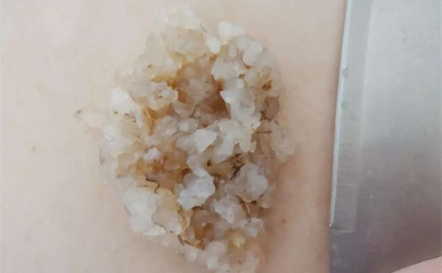 鲜虾白菜丸子的做法 8个月宝宝辅食食谱