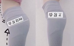 怎么判断自己产后需不需要进行骨盆修复？