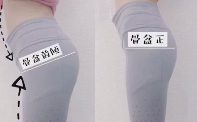 怎么判断自己产后需不需要进行骨盆修复？