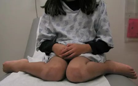 孩子W坐有危害吗 正确的坐姿什么样