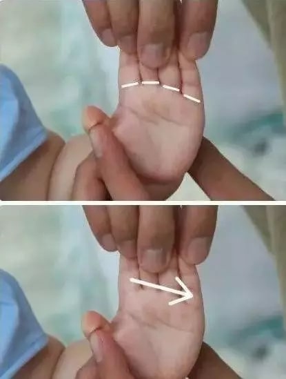 实用的小儿推拿方法图文教程