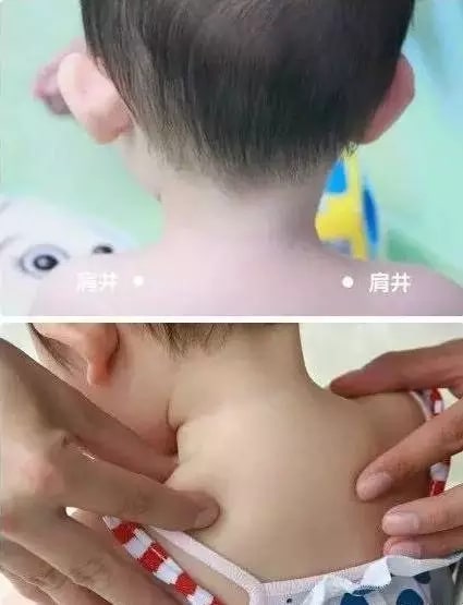 实用的小儿推拿方法图文教程