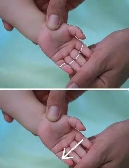 实用的小儿推拿方法图文教程