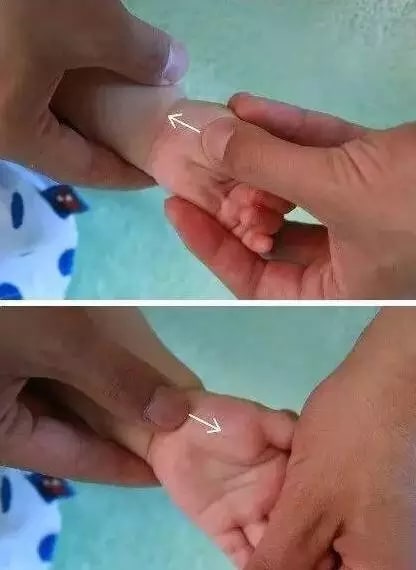 实用的小儿推拿方法图文教程