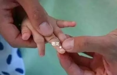 实用的小儿推拿方法图文教程