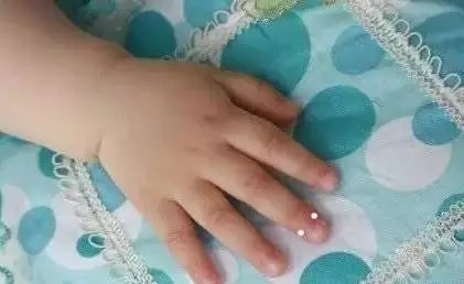 实用的小儿推拿方法图文教程