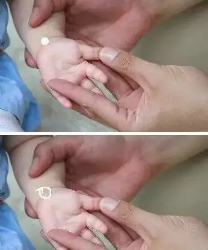 实用的小儿推拿方法图文教程