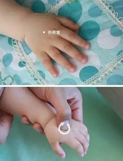 实用的小儿推拿方法图文教程