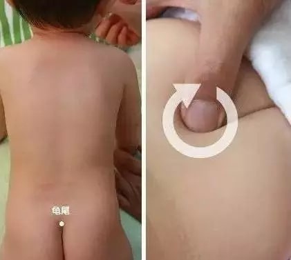 实用的小儿推拿方法图文教程