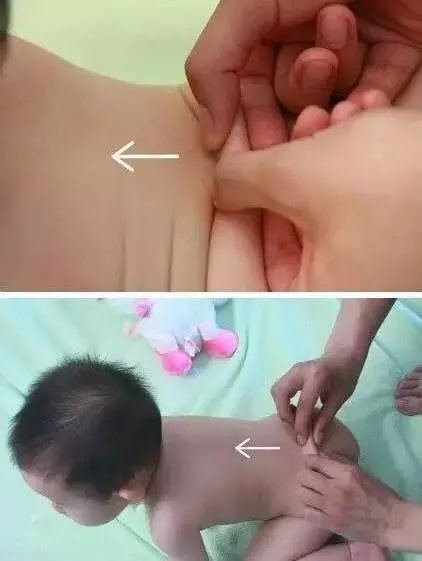 实用的小儿推拿方法图文教程