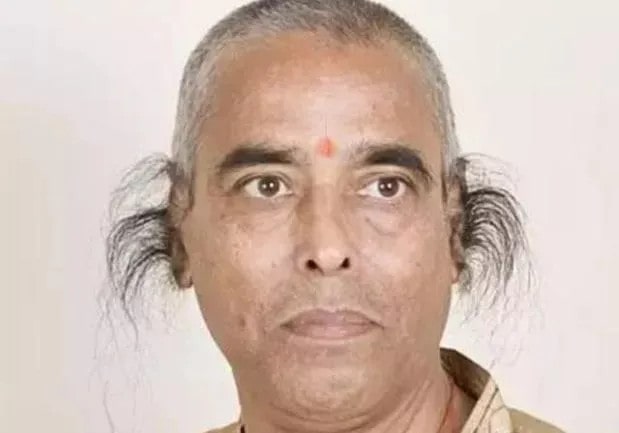 这些遗传病，传男不传女