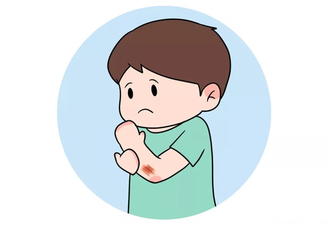 这些遗传病，传男不传女