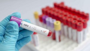 乙肝大三阳能怀孕吗