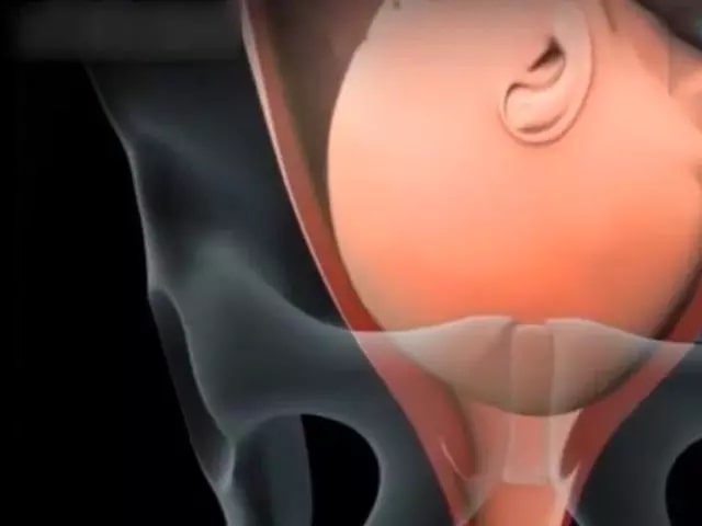 孕妇顺产过程是怎么样的