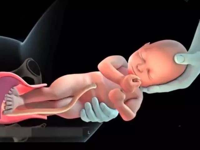 孕妇顺产过程是怎么样的