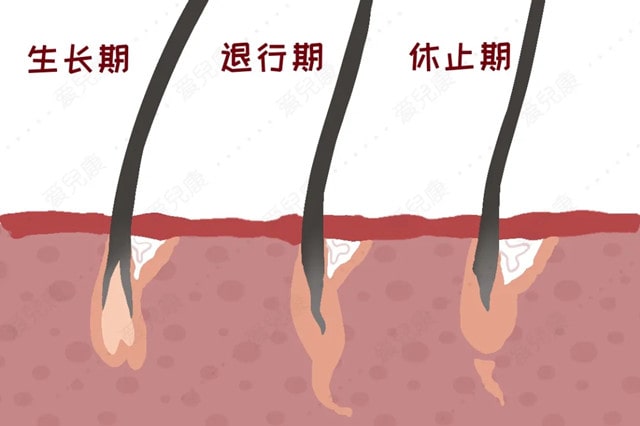 产后脱发的原因 产后脱发怎么办