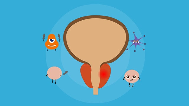 前列腺炎能生育吗