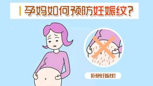 怎么预防妊娠纹产生