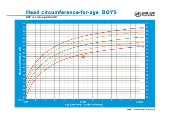 怎么判断宝宝头围大小是否正常？