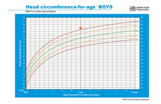 怎么判断宝宝头围大小是否正常？