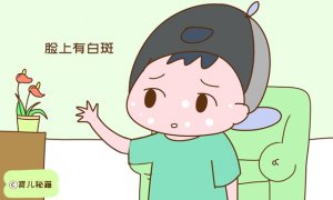 小孩脸上有白斑，是肚子里长虫了吗？