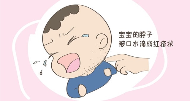 婴儿淹脖子怎么办