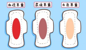 产后恶露颜色