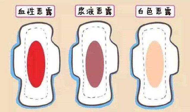 剖腹产后恶露多久排完