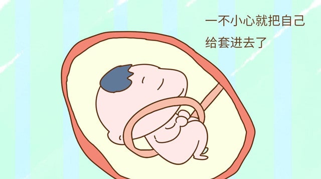 脐带绕颈一般会发生在胎儿发育的第几个月？