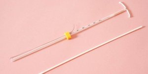 取环后有血丝正常吗