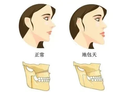 宝宝多大该戒奶瓶？