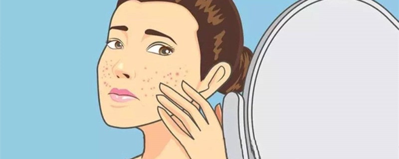 孕妇脸部过敏怎么办