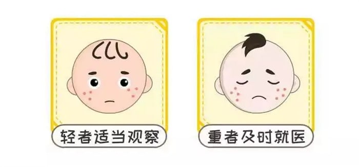 宝宝牛奶蛋白过敏有哪些表现？