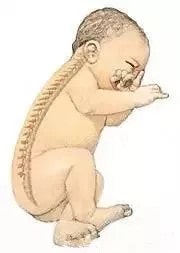 新生儿需要枕头吗