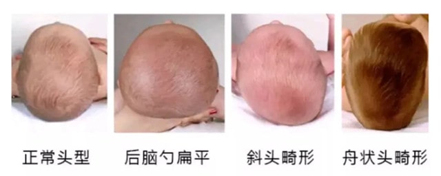 新生儿需要枕头吗