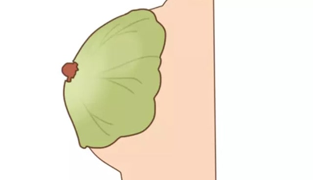 哺乳期乳房肿胀疼痛怎么办？