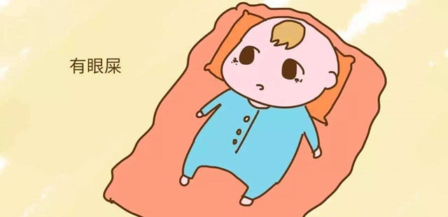 新生儿眼屎多是什么原因