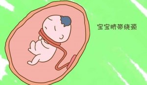 准妈妈如何应对脐带绕颈？