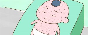 婴儿急疹症状及处理