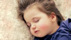 宝宝冬天脸皮肤干燥怎么护理