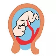 胎盘位置低能顺产吗